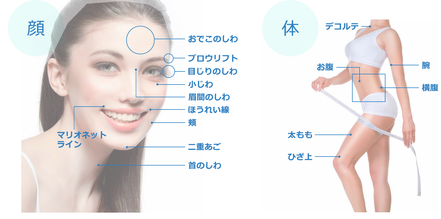 ハイフ治療とは