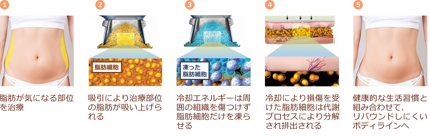 α式脂肪冷却装置
