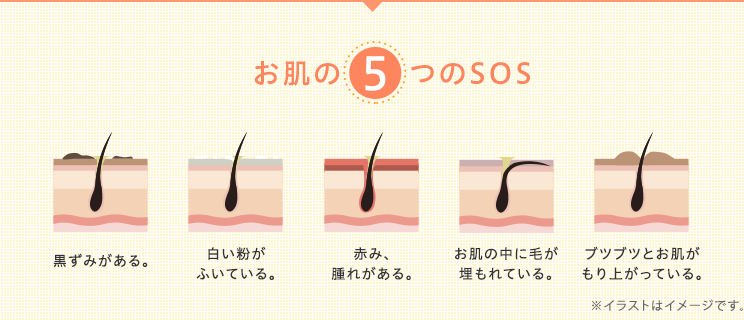 お肌の 5 つのSOS