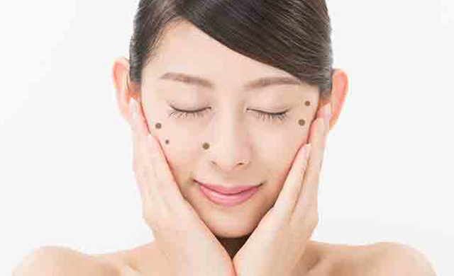 脂漏性角化症　しろうせいかっかしょう