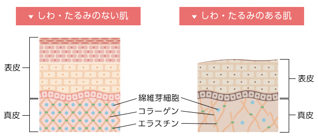 しわとは