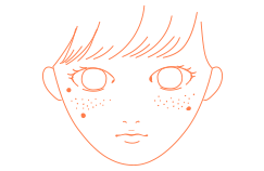 しみ・そばかす・肝斑