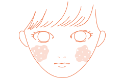 アトピー性皮膚炎
